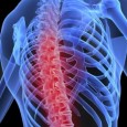   Você sabia que: A maioria das fraturas são complicações de baixa massa óssea ou osteoporose. Muitos casos de dor nas costas têm como causa uma fratura vertebral por achatamento, que pode ser subdiagnosticada ou mesmo ignorada. A osteoporose é […]